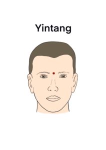 yintang acupuncture point for qigong
